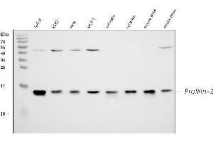 Western blot analysis of Profilin1 using anti-Profilin1 antibody (ABIN3043603).