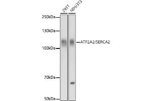 Western Blotting (WB) image for anti-ATPase, Ca++ Transporting, Cardiac Muscle, Slow Twitch 2 (ATP2A2) (AA 111-253) antibody (ABIN3021430)