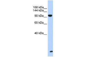 Western Blotting (WB) image for anti-Trinucleotide Repeat Containing 6B (TNRC6B) antibody (ABIN2458485) (TNRC6B 抗体)