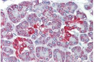 Immunohistochemistry (Paraffin-embedded Sections) (IHC (p)) image for anti-Solute Carrier Family 39 (Metal Ion Transporter), Member 5 (SLC39A5) (AA 38-87) antibody (ABIN6741604)
