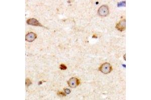 Immunohistochemical analysis of ME3 staining in human brain formalin fixed paraffin embedded tissue section.