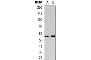 Western Blotting (WB) image for anti-Cytochrome P450, Family 2, Subfamily S, Polypeptide 1 (CYP2S1) (Center) antibody (ABIN7300598)