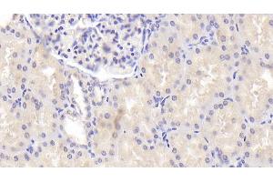 Detection of ENDOG in Human Kidney Tissue using Polyclonal Antibody to Endonuclease G, Mitochondrial (ENDOG) (Endonuclease G 抗体  (AA 16-290))