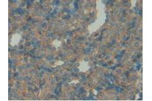 Detection of IGFBP7 in Rat Spleen Tissue using Polyclonal Antibody to Insulin Like Growth Factor Binding Protein 7 (IGFBP7) (IGFBP7 抗体  (AA 88-281))