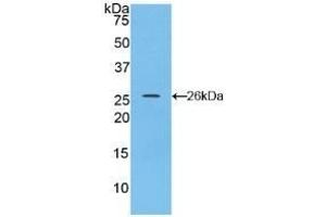 Detection of Recombinant CX43, Rat using Polyclonal Antibody to Connexin 43 (CX43) (Connexin 43/GJA1 抗体  (AA 180-382))