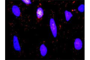 Proximity Ligation Analysis of protein-protein interactions between BTC and ERBB2. (Betacellulin 抗体  (AA 1-178))