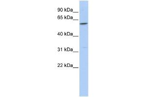 WB Suggested Anti-CEACAM16 Antibody Titration:  0. (CEACAM16 抗体  (Middle Region))