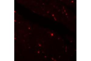 Immunofluorescence of KLOTOH in mouse heart tissue with KLOTHO antibody at 20 ug/ml. (Klotho 抗体  (Center))