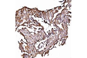 IHC analysis of ORP150/HYOU1 using anti-ORP150/HYOU1 antibody (ABIN7601807). (HYOU1 抗体  (AA 46-913))