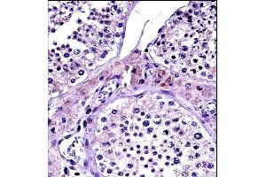 NR0B1 Antibody (Center) (ABIN657696 and ABIN2846687) immunohistochemistry analysis in formalin fixed and paraffin embedded human testis tissue followed by peroxidase conjugation of the secondary antibody and DAB staining.
