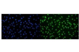 IF analysis of CAMKIV/Camk4 using anti-CAMKIV/Camk4 antibody (ABIN7600419). (CAMK4 抗体  (AA 19-469))