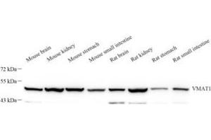 Western blot analysis of VMAT1 (ABIN7075654) at dilution of 1: 1000 (SLC18A1 抗体)