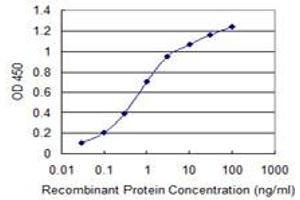 Detection limit for recombinant GST tagged WNK4 is 0. (WNK4 抗体  (AA 1144-1243))