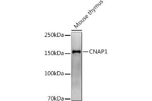 Western blot analysis of extracts of Mouse thymus, using (ABIN7268948) at 1:1000 dilution. (NCAPD2 抗体)