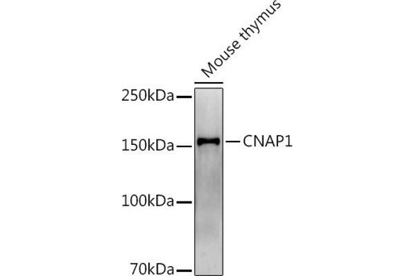NCAPD2 抗体