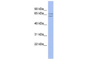 WB Suggested Anti-SLU7 Antibody Titration: 0. (SLU7 抗体  (N-Term))
