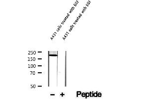 Western blot analysis of extracts of A431 cells treated with EGF, using Phospho-Afadin (Ser1799) Antibody. (Afadin 抗体  (pSer1799))