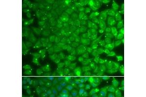 Immunofluorescence analysis of A549 cells using KBTBD7 Polyclonal Antibody (KBTBD7 抗体)