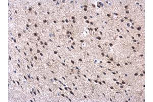 IHC-P Image MPP3 antibody [N1C1] detects MPP3 protein at cytoplasm and nucleus in mouse brain by immunohistochemical analysis. (MPP3 抗体  (Center))