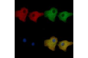 alpha Tubulin Mouse Monoclonal Antibody staining Hela cells by IF/ICC.