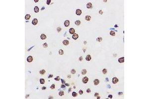 Immunohistochemical analysis of PRDM14 staining in human kidney formalin fixed paraffin embedded tissue section. (PRDM14 抗体)