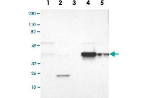 Western Blot analysis of Lane 1: RT-4, Lane 2: U-251MG sp, Lane 3: human plasma (IgG/HSA depleted), Lane 4: human liver and Lane 5: human tonsil lysates with FAM50A polyclonal antibody . (FAM50A 抗体)