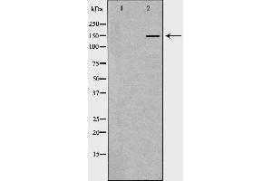 Western blot analysis of extracts of liver , using INSR antibody. (Insulin Receptor 抗体  (Internal Region))