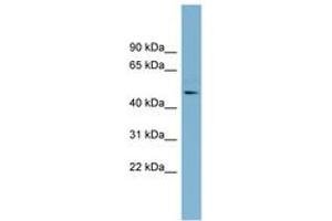 Image no. 1 for anti-Trimethyllysine Hydroxylase, epsilon (TMLHE) (AA 323-372) antibody (ABIN6742153) (TMLHE 抗体  (AA 323-372))