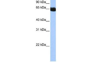 WB Suggested Anti-NSUN6 Antibody Titration:  0. (NSUN6 抗体  (N-Term))