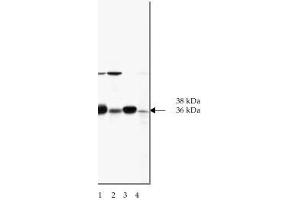 Image no. 1 for anti-SNAP alpha/beta antibody (ABIN364556) (SNAP alpha/beta 抗体)