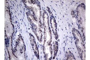 Image no. 7 for anti-TIA1 Cytotoxic Granule-Associated RNA Binding Protein (TIA1) antibody (ABIN1501387)