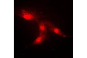 Immunofluorescent analysis of CRABP2 staining in HeLa cells. (CRABP2 抗体  (Center))