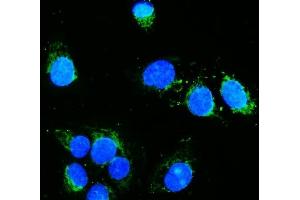 IF analysis of Hexokinase 1/HK1 using anti-Hexokinase 1/HK1 antibody (ABIN7600258). (Hexokinase 1 抗体  (AA 17-323))
