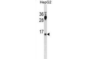 CYYR1 Antibody (C-term) (ABIN1881247 and ABIN2838999) western blot analysis in HepG2 cell line lysates (35 μg/lane). (CYYR1 抗体  (C-Term))