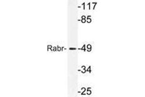 Western blot (WB) analysis of Rabr antibody in extracts from MCF-7cells. (AGFG2 抗体)
