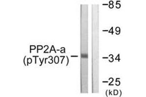 Western blot analysis of extracts from A549 cells, using PP2A-alpha (Phospho-Tyr307) Antibody. (PPP2CA 抗体  (pTyr307))