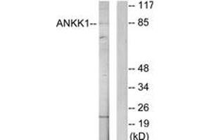 Western blot analysis of extracts from HeLa cells, using ANKK1 Antibody. (ANKK1 抗体  (AA 321-370))