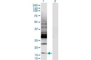 Western Blot analysis of CREBL2 expression in transfected 293T cell line by CREBL2 monoclonal antibody (M04), clone 1C1. (CREBL2 抗体  (AA 1-120))