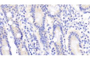 Detection of TRAF1 in Human Small intestine Tissue using Polyclonal Antibody to TNF Receptor Associated Factor 1 (TRAF1) (TRAF1 抗体  (AA 131-381))