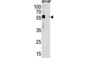 Western Blotting (WB) image for anti-Sequestosome 1 (SQSTM1) (AA 317-346) antibody (ABIN3031543)