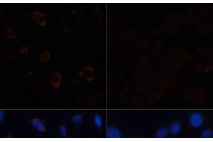 Immunofluorescence analysis of HeLa cells using ACACA Polyclonal Antibody at dilution of 1:100. (Acetyl-CoA Carboxylase alpha 抗体)