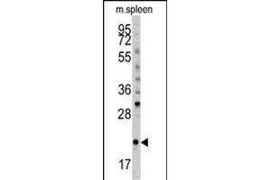 Western blot analysis of anti-mouse BID Antibody (S61) (ABIN388100 and ABIN2846184) in mouse spleen tissue lysates (35 μg/lane). (BID 抗体  (AA 39-68))