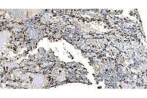 IHC analysis of Coronin 1a/TACO/CORO1A using anti-Coronin 1a/TACO/CORO1A antibody (ABIN7600292).