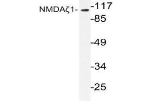 Western blot (WB) analyzes of NMDAζ1 antibody in extracts from Jurkat cells. (NMDA 1 Receptor 抗体)