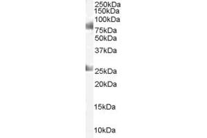 ABIN184904 staining (1µg/ml) of Human Testes lysate (RIPA buffer, 35µg total protein per lane). (CDYL 抗体  (C-Term))