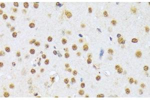 Immunohistochemistry of paraffin-embedded Mouse brain using A1CF Polyclonal Antibody at dilution of 1:100 (40x lens). (A1CF 抗体)