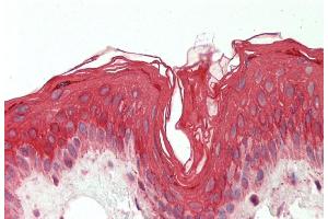 Rabbit Anti-KRT19 antibody Catalog Number: ARP41731 Formalin Fixed Paraffin Embedded Tissue: Human Skin Primary antibody Concentration: 1:100 Secondary Antibody: Donkey anti-Rabbit-Cy3 Secondary Antibody Concentration: 1:200 Magnification: 20x Exposure Time: 0.