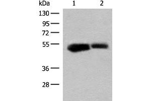 Western blot analysis of Mouse liver tissue and Rat liver tissue lysates using GLUD1 Polyclonal Antibody at dilution of 1:200 (GLUD1 抗体)