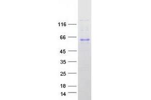 Western Blotting (WB) image for Family with Sequence Similarity 134, Member B (FAM134B) (Transcript Variant 2) protein (Myc-DYKDDDDK Tag) (ABIN2720752)
