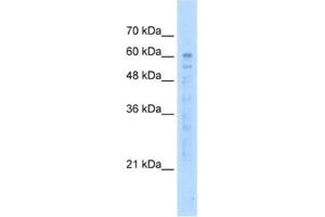 Western Blotting (WB) image for anti-EF-hand calcium binding domain 14 (EFCAB14) antibody (ABIN2463041) (KIAA0494 抗体)